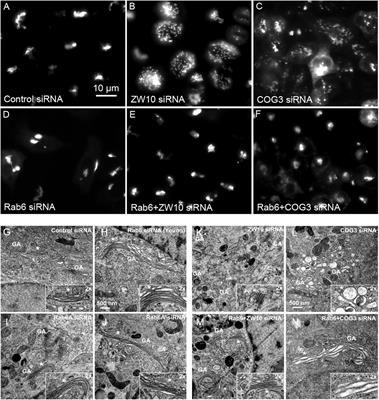 Epistatic Analysis of the Contribution of Rabs and Kifs to CATCHR Family Dependent Golgi Organization